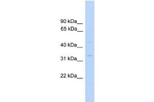 WB Suggested Anti-MTFMT Antibody Titration:  0. (MTFMT 抗体  (C-Term))