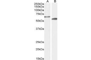 Western Blotting (WB) image for anti-Cytochrome P450, Family 2, Subfamily R, Polypeptide 1 (CYP2R1) (AA 405-418) antibody (ABIN6391375)