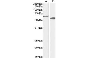 ABIN6391375 (2µg/ml) staining of Mouse (A) and Rat (B) Testes lysate (35µg protein in RIPA buffer). (CYP2R1 抗体  (AA 405-418))