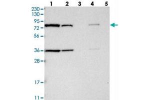 Western blot analysis of Lane 1: RT-4, Lane 2: U-251 MG, Lane 3: Human Plasma, Lane 4: Liver, Lane 5: Tonsil with HSD17B4 polyclonal antibody  at 1:250-1:500 dilution. (HSD17B4 抗体)