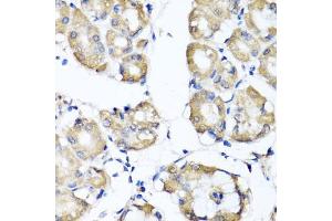 Immunohistochemistry of paraffin-embedded human stomach using RBP2 antibody (ABIN5974059) at dilution of 1/100 (40x lens). (RBP2 抗体)