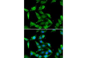Immunofluorescence analysis of U2OS cells using GAMT antibody (ABIN5973964). (GAMT 抗体)