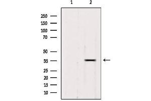 Western blot analysis of extracts from 293, using RALY Antibody. (Raly 抗体  (Internal Region))