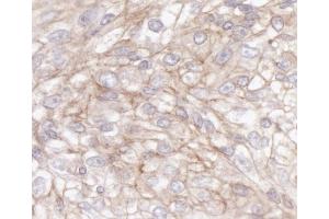 Immunohistochemistry (IHC) image for anti-IQ Motif Containing GTPase Activating Protein 1 (IQGAP1) (AA 1-50) antibody (ABIN7453634)