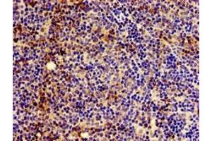 Immunohistochemistry of paraffin-embedded human lymph node tissue using ABIN7155567 at dilution of 1:100 (HLA-C 抗体  (AA 200-306))
