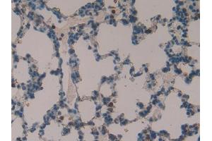 DAB staining on IHC-P; Samples: Rat Lung Tissue (TOR2A 抗体  (AA 34-293))