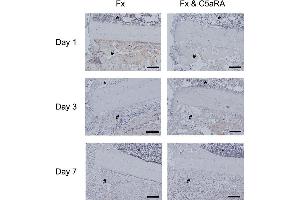 Immunostaining of IL-6 on day 1, 3 and 7 in tissue sections of control animals (Fx) and after administration of C5aRA (Fx & C5aRA) showing the callus region in detail (fracture gap on the left, cortex in the middle, bone marrow on top (*) and periosteal callus (#) on the bottom of the image. (IL-6 抗体  (AA 101-150))