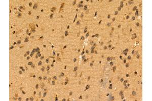ABIN6257271 and ABIN6274269 at 1/100 staining Mouse brain tissue by IHC-P.