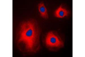 Immunofluorescent analysis of RPS4X staining in A431 cells. (RPS4X 抗体  (Center))