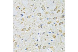 Immunohistochemistry of paraffin-embedded mouse brain using ATG7 antibody. (ATG7 抗体)