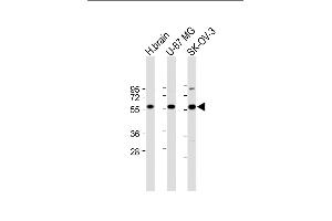 Western Blotting (WB) image for anti-Dynein, Cytoplasmic 1, Light Intermediate Chain 2 (DYNC1LI2) (AA 152-180) antibody (ABIN651669)