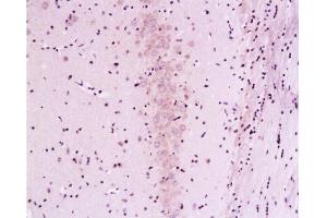 Formalin-fixed and paraffin embedded rat brain labeled with Mouse Anti-Calcineurin A/PP-2B alpha 1 Polyclonal Antibody , Unconjugated 1:200 followed by conjugation to the secondary antibody and DAB staining