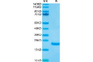 Biotinylated Human IL-10 on Tris-Bis PAGE under reduced condition. (IL-10 Protein (His-Avi Tag,Biotin))