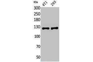 Western Blot analysis of 4T1, 293 cells using Integrin αD Polyclonal Antibody. (ITGAD 抗体  (Internal Region))