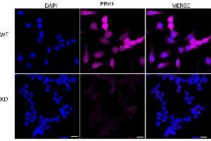 Immunocytochemical staining of HeLa cells using ERK1 antibody (ABIN7799450), 1:1,000), Top panel: wild-type (WT), Bottom panal: ERK1 shRNA knockdown (KD).