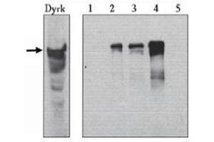 Image no. 1 for anti-Dual-Specificity tyrosine-(Y)-phosphorylation Regulated Kinase 1A (DYRK1A) (AA 486-763) antibody (ABIN264978)