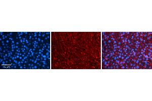 Rabbit Anti-COPS2 Antibody   Formalin Fixed Paraffin Embedded Tissue: Human Liver Tissue Observed Staining: Cytoplasm in hepatocytes and endothelial cells in sinusoids Primary Antibody Concentration: 1:100 Other Working Concentrations: 1:600 Secondary Antibody: Donkey anti-Rabbit-Cy3 Secondary Antibody Concentration: 1:200 Magnification: 20X Exposure Time: 0. (COPS2 抗体  (N-Term))