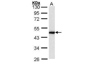 WB Image Sample (30 ug of whole cell lysate) A: HeLa 10% SDS PAGE antibody diluted at 1:1000 (KRT16 抗体  (C-Term))