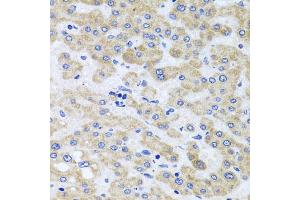 Immunohistochemistry of paraffin-embedded human liver injury using PEX3 antibody (ABIN5975508) at dilution of 1/100 (40x lens). (PEX3 抗体)