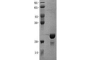 Validation with Western Blot (ZBTB17 Protein (His tag))