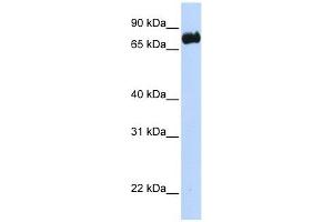 LRCH4 antibody used at 1 ug/ml to detect target protein. (LRCH4 抗体)