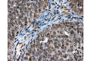 Immunohistochemical staining of paraffin-embedded Kidney tissue using anti-DAPK2 mouse monoclonal antibody. (DAPK2 抗体)