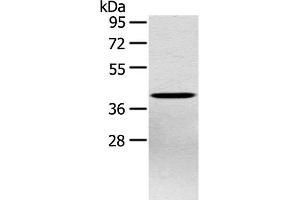 Western Blot analysis of Hepg2 cell using PTX3 Polyclonal Antibody at dilution of 1:400 (PTX3 抗体)