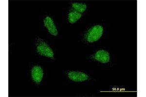 Immunofluorescence of monoclonal antibody to PIM1 on HeLa cell. (PIM1 抗体  (AA 1-100))