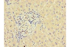 Immunohistochemistry of paraffin-embedded human liver tissue using ABIN7154242 at dilution of 1:100 (GLT8D1 抗体  (AA 33-332))