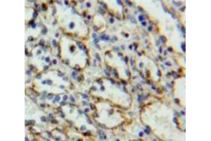 Used in DAB staining on fromalin fixed paraffin-embedded Spleen tissue (IL27 Receptor alpha 抗体  (AA 123-343))