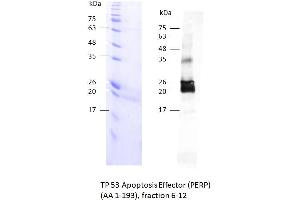 Image no. 2 for TP53 Apoptosis Effector (PERP) (AA 1-193) protein (Strep Tag) (ABIN3105096)