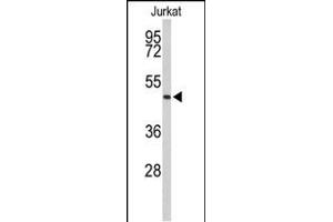 Western blot analysis of ACR Antibody (C-term) (ABIN653021 and ABIN2842643) in Jurkat cell line lysates (35 μg/lane). (Acrosin 抗体  (C-Term))