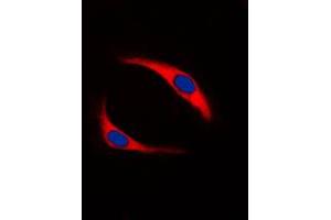 Immunofluorescent analysis of SYK (pY323) staining in Ramos cells. (SYK 抗体  (pTyr323))