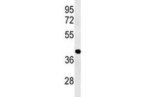 Western blot analysis of ATF1 antibody and Jurkat lysate (AFT1 抗体  (AA 193-219))