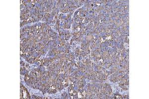 IHC analysis of MUC1 using anti-MUC1 antibody (ABIN7602711).