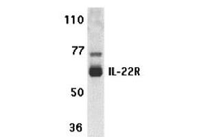 Western Blotting (WB) image for anti-Interleukin 22 Receptor (IL22R) (N-Term) antibody (ABIN1031411) (IL22R 抗体  (N-Term))