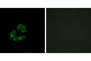 Peptide - +Western blot analysis of extracts from Jurkat cells, using ARFIP1 antibody. (ARFIP1 抗体)