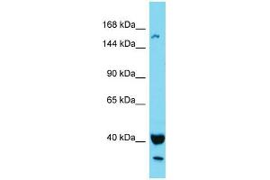 Western Blotting (WB) image for anti-KIAA1683 (KIAA1683) (N-Term) antibody (ABIN2791618) (KIAA1683 抗体  (N-Term))