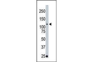 Image no. 1 for anti-Serine/threonine Kinase 10 (STK10-A) (C-Term) antibody (ABIN360364) (STK10-A 抗体  (C-Term))