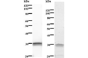 Left: BCL3 staining. (BCL3 抗体)