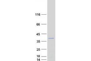 Western Blotting (WB) image for Gem (Nuclear Organelle) Associated Protein 8 (GEMIN8) (Transcript Variant 3) protein (Myc-DYKDDDDK Tag) (ABIN2721806)