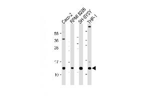 All lanes : Anti-CKS2 Antibody (C-Term) at 1:2000 dilution Lane 1: Caco-2 whole cell lysate Lane 2: RI 8226 whole cell lysate Lane 3: SH-SY5Y whole cell lysate Lane 4: THP-1 whole cell lysate Lysates/proteins at 20 μg per lane. (CKS2 抗体  (AA 43-77))