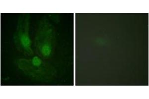 Immunofluorescence analysis of HeLa cells, using PKC zeta (Ab-410) Antibody. (PKC zeta 抗体  (AA 376-425))