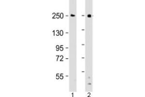 Western blot testing of human 1) Ramos and 2) THP-1 cell lysate with DOCK8 antibody at 1:2000. (DOCK8 抗体  (AA 2056-2090))