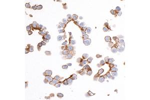 Immunocytochemistry (ICC) image for anti-Epithelial Cell Adhesion Molecule (EPCAM) (AA 264-314) antibody (ABIN7455204) (Recombinant EpCAM 抗体  (AA 264-314))