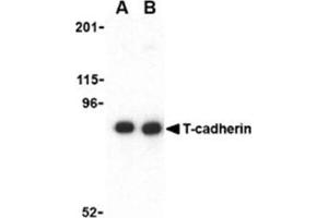 Image no. 1 for anti-Cadherin 13 (CDH13) (N-Term) antibody (ABIN318711) (Cadherin 13 抗体  (N-Term))