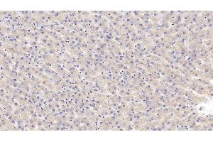 Immunohistochemistry (IHC) image for anti-Calreticulin (CALR) (AA 18-193) antibody (ABIN7433687)