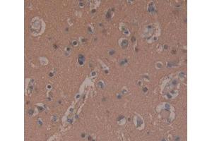 Used in DAB staining on fromalin fixed paraffin- embedded brain tissue (PDE10A 抗体  (AA 508-779))