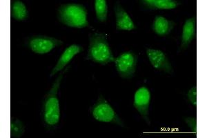 Immunofluorescence of monoclonal antibody to UBE2N on HeLa cell.