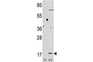 Western Blotting (WB) image for anti-Microtubule-Associated Protein 1 Light Chain 3 beta (MAP1LC3B) (AA 77-106) antibody (ABIN3029808)